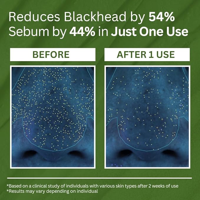 Holy Basil Bubble Deep Mask™ — Blast Away Dullness and Reveal Radiant, Calm Skin Instantly